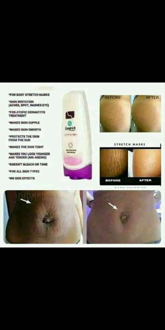  lait reparateur anti vergetures